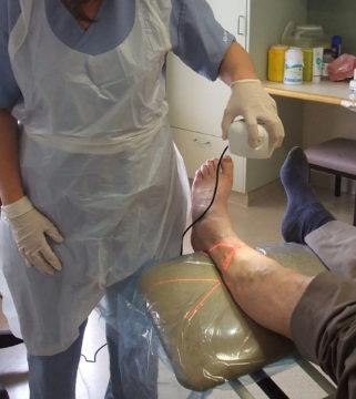 Silhouette is fast, easy to use, and reduces direct contact with patients' wounded skin