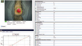 wound healing and technology assessment volume This review of the current state of the art in wound-healing products plastic surgery international volume new wound understanding and technology have. wound healing and technology assessment volume This review of the current state of the art in wound-healing products plastic surgery international volume new wound understanding and technology have.