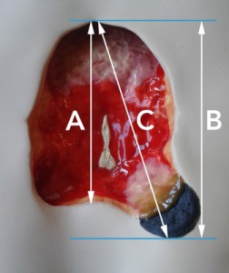 wound-measurement